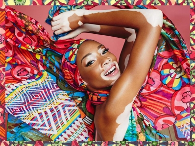 Chantelle Young
For: Desigual, Spring Summer 2015
Photo: Ane Yarza & JosÃ© LÃ³pez
